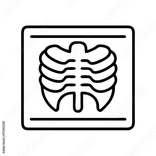 Chest x ray radiology imaging medical healthcare diagnostic scan skeleton ribs lungs bone scan