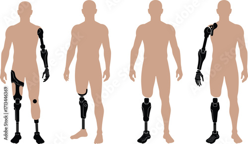 Vector illustration of diverse human figures with various prosthetic limbs, highlighting modern artificial limb technology, rehabilitation, mobility, and accessibility concepts