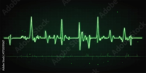 Green ECG wave showing a healthy heart's pulse and rate on a medical monitor in a hospital