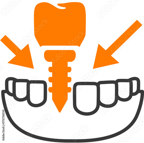 Tooth Cavity Filling
