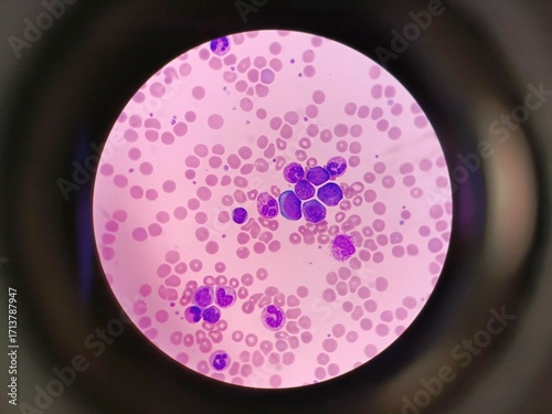 Blood Pathology Under Microscope – Medical Analysis 