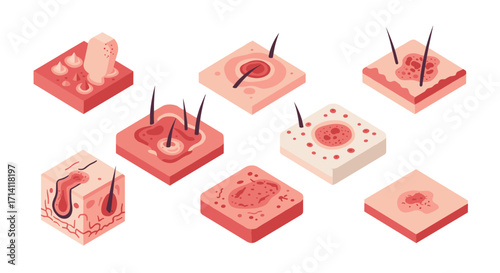 Various skin conditions and anatomy in 3d isometric style