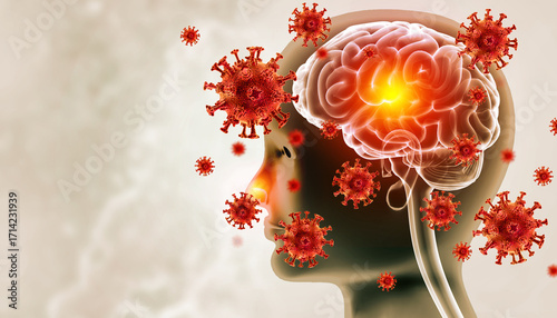 Bild auf Leinwand Brain viral infection, Viral meningitis and encephalitis
