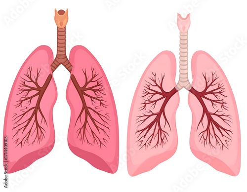 Anatomical diagram of healthy and diseased lungs
