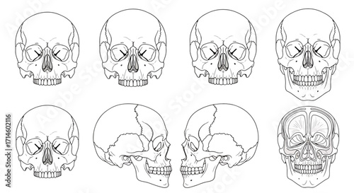 Detailed anatomical illustration of human skulls in multiple perspectives including side, front, and angled views for medical and educational reference.