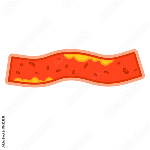 Illustration of Cholesterol in Blood