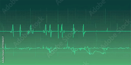 Green line heartbeat monitor ECG cardiogram wave pulse medical illustration showing health test rate on a hospital technology chart