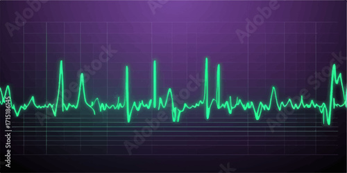 Green vector line showing EKG heartbeat pulse on a medical monitor graph