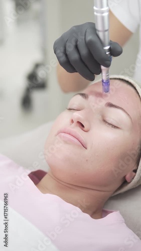 Vertical video of a woman undergoing a microneedling facial treatment at a beauty salon. The cosmetologist uses a dermapen device on the client is forehead to rejuvenate the skin, improve texture,