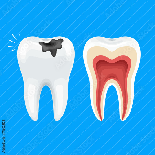 Understanding Dental Health and Tooth Decay Exploring the Structure and Damage of Your Teeth
