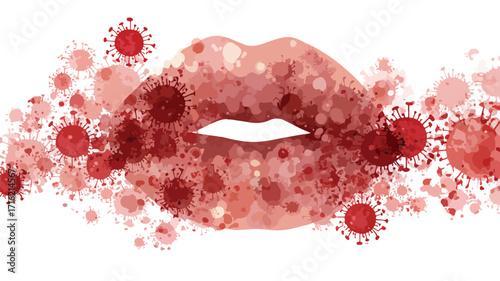 Herpes Virus on Lips Vector Illustration for Medical Concepts