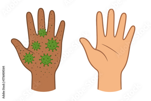 Clean and dirty hand concept. Washing hands for hygiene. Dirty hand with coronavirus germs vs a clean hand. Metaphor for disease prevention, infection and personal health.
