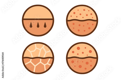 Skin type icons set. Vector illustration of skin types: normal, oily, dry, and sensitive. Dermatology and skincare concept icons. Cross-section of skin layers and texture.