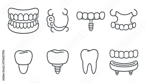 Dental implants and prosthetics overview: types and structures of artificial teeth