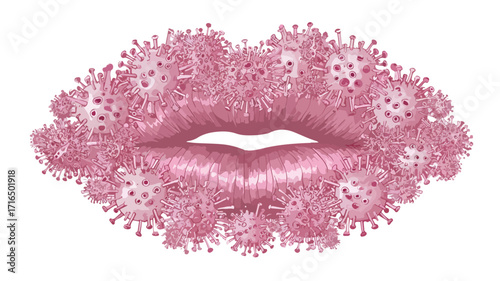 Herpes Virus on Lips Vector Illustration for Medical Concepts