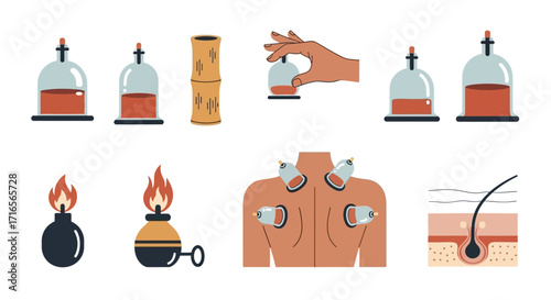 A collection of flat vector illustrations depicting traditional Chinese cupping therapy equipment and its application process.