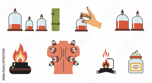Illustrated Cupping Therapy Set - Glass Cups, Flame, and Human Back Depiction.