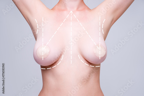 Breast augmentation, woman with saggy breasts before aesthetic lifting procedure, reduction mammoplasty, plastic surgery concept