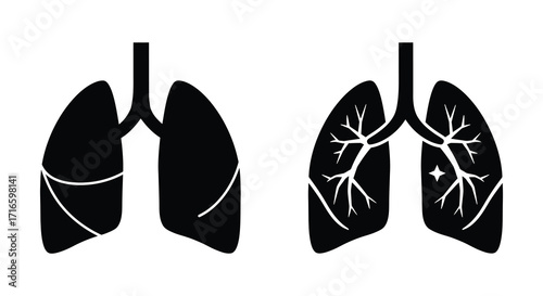 Illustration of healthy and diseased lungs showing bronchial tree structure