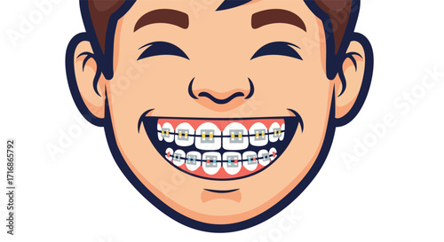 Smiling Boy with Braces Showing His Happy Teeth