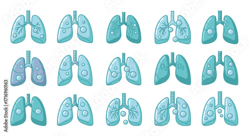 Stages of Lung Disease Progression Illustrations.