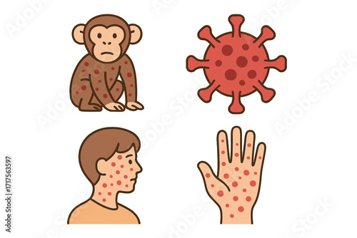 Monkeypox virus infection symptoms icon set. Mpox disease concept. Skin rash, pustules on face and hand. Monkey, virus cell. Medical vector illustration for pandemic info.