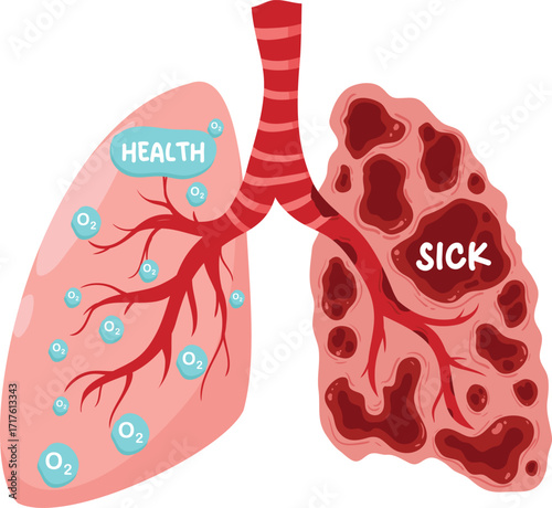 Healthy vs. Sick Lungs A Visual Comparison