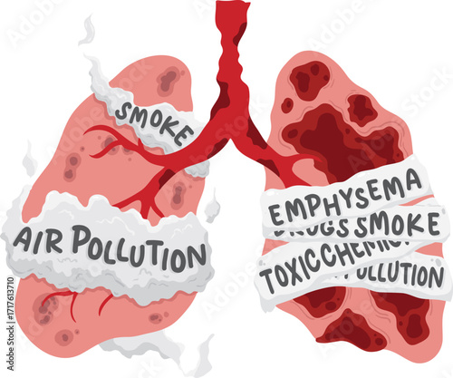 Lung Health The Impact of Air Pollution and Smoking