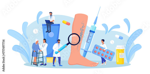 Vein Thrombosis and Varicose Treatment. Tiny Doctor with Magnifying Glass and Drugs around of Huge Foot with Diseased Veins. Elderly Woman came to Specialists for Examination Blood Vessels and Veins