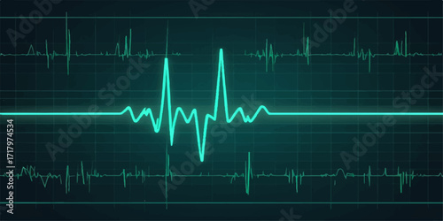 An electrocardiogram (ECG) trace of a healthy heartbeat on a medical monitor