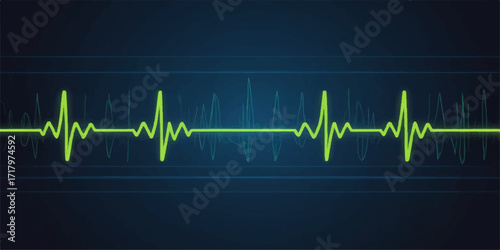 Green electrocardiogram line showing a healthy heartbeat on a medical monitor