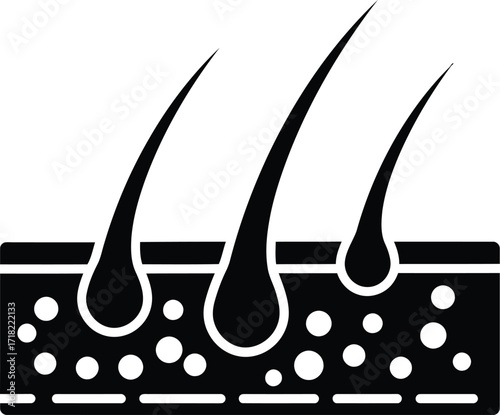 Illustration of human skin with hair follicles and subcutaneous tissue