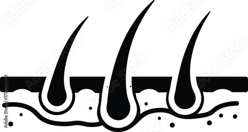 Simple black and white illustration depicting hair follicles and skin surface