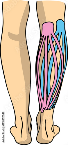 A kinesiology tape on a leg. Vector illustration.