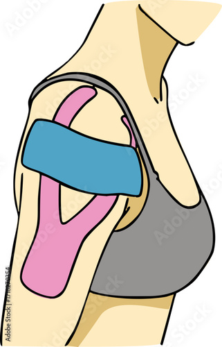 A kinesiology tape on a shoulder. Vector illustration.