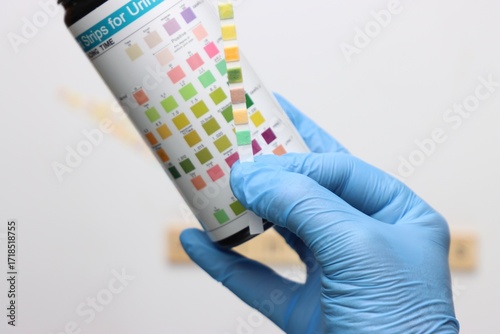 Urinalysis strips to test urine sample in a light background and copy space