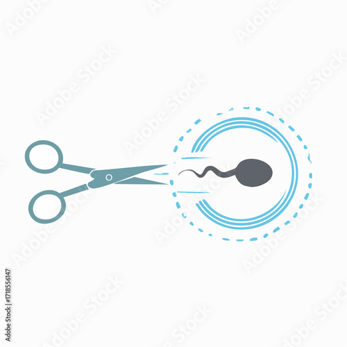 Vasectomy Procedure with Scissors Cutting Sperm