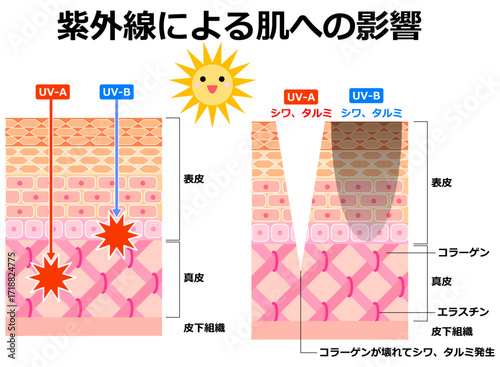 紫外線による肌への影響