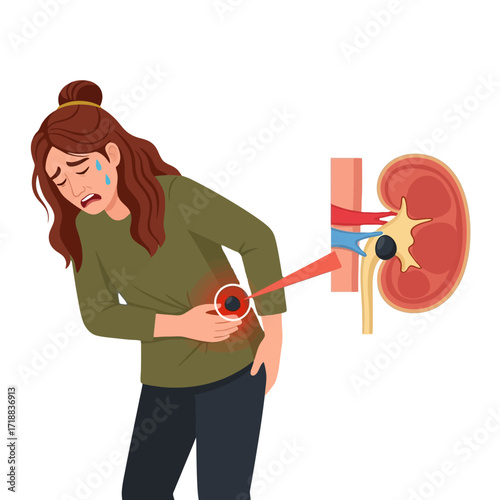 Worried woman experiencing intense kidney pain from kidney stone, educational medical illustration explaining urology and kidney disease for health awareness campaigns