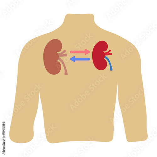 kidney transplant 
