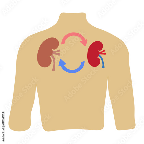 kidney transplant 