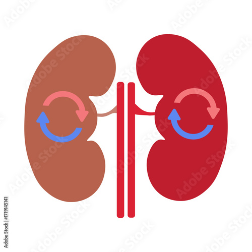 kidney transplant 