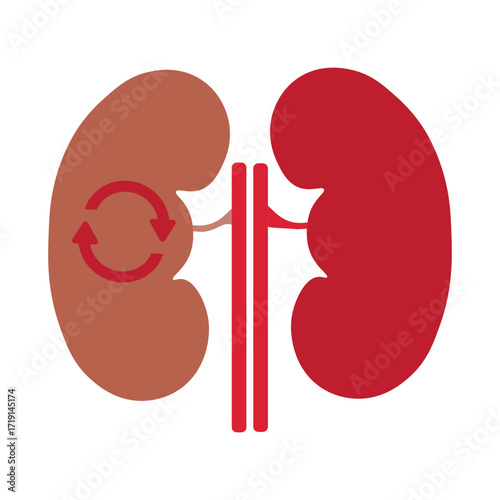 kidney transplant 