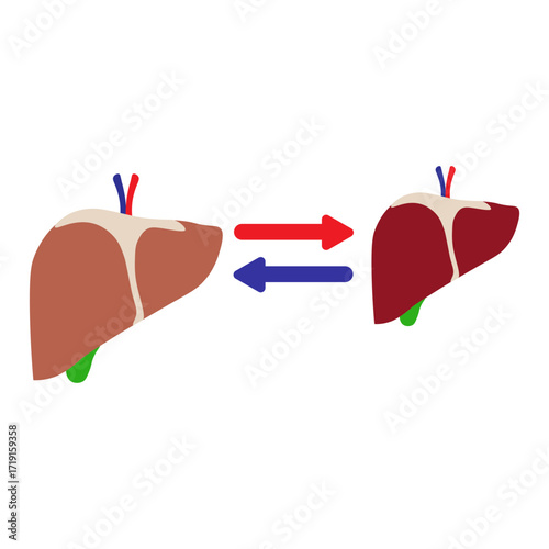 Liver Transplant Medical Icon