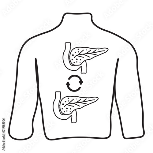 Pancreas Transplant line icon