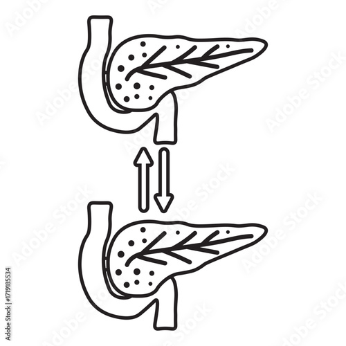 Pancreas Transplant line icon