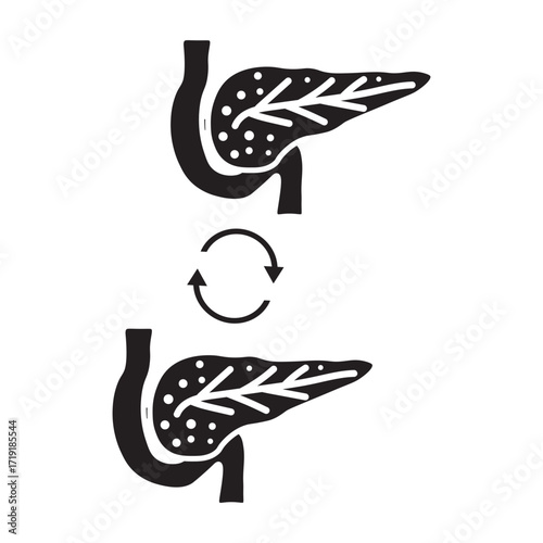 Pancreas Transplant glyph icon