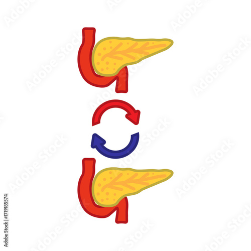 Pancreas Transplant Medical Icon