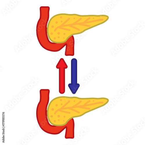 Pancreas Transplant Medical Icon