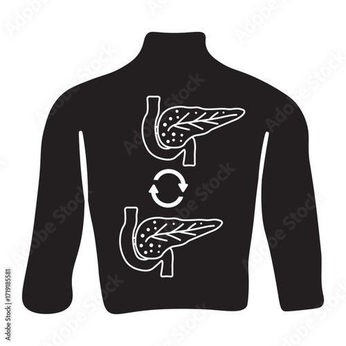 Pancreas Transplant glyph icon
